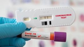 Ilustrasi rapid test. (Foto: Pelopor.id/Shutterstock)