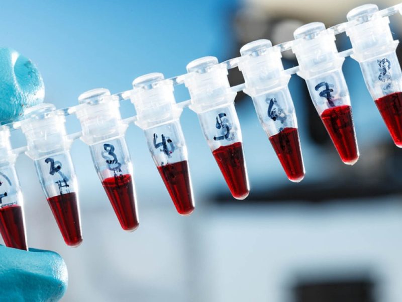 Ilustrasi sample test PCR. (Foto:Pelopor.id/Ist)