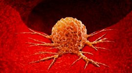 Ilustrasi tumor. (Foto: istimewa)