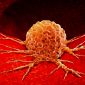 Ilustrasi tumor. (Foto: istimewa)